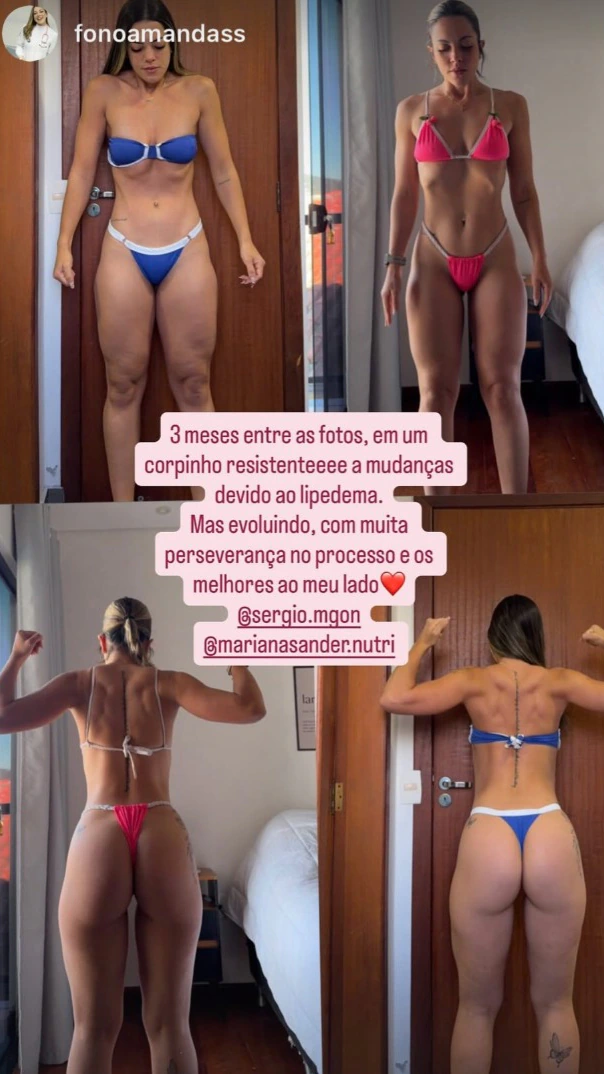 Comparação de registros de evolução corporal, de frente e de costas.