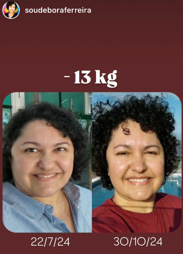 Comparação de retratos em dois momentos do acompanhamento.
