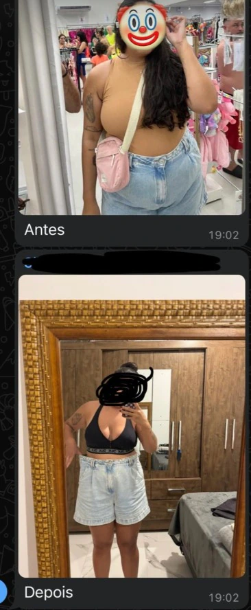 Comparação de fotografias de acompanhamento, identificadas como antes e depois.